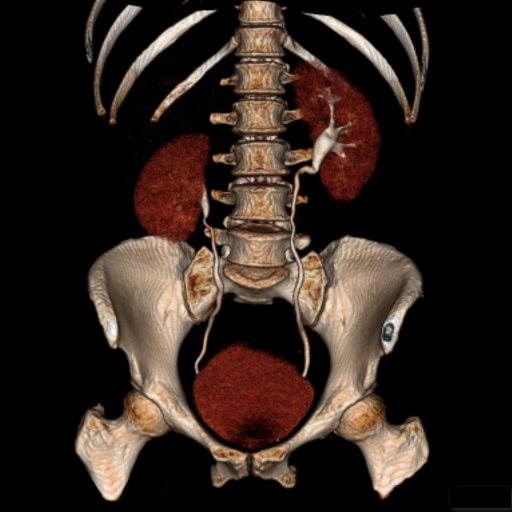 Le scanner - Radiologie Bordeaux