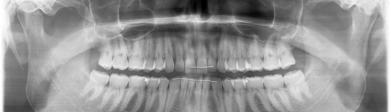 orthopangonogramme